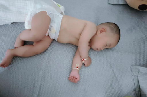 大庆六个月宝宝眼睛散光